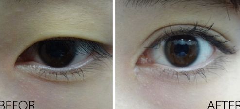 長沙的吉大二院整形科效果如何？項目費用一覽表2023