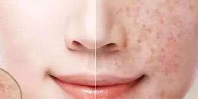 2023年大連顴骨顴弓修復(fù)醫(yī)生推薦，醫(yī)師排行公開(kāi)！附最新收費(fèi)一覽！