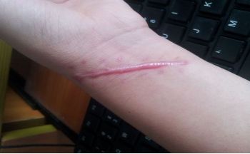 哈爾濱市第五醫(yī)院整容科負(fù)責(zé)人是誰(shuí)？名醫(yī)陣容+服務(wù)價(jià)目公示給您參考