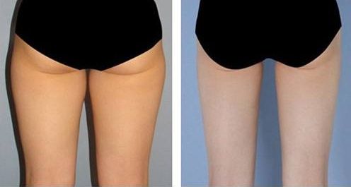 【2023】成都黃金微雕著名醫(yī)師盤點，你不容錯過！