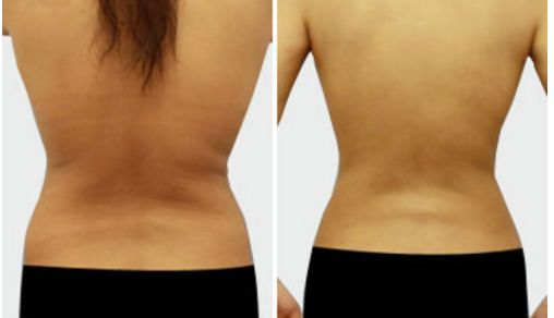 名醫(yī)孟祥宏師傅：創(chuàng)造完美鼻型的心靈藝術(shù)！