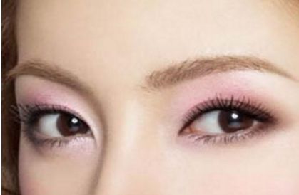 北京協(xié)和醫(yī)院白明醫(yī)生的雙眼皮手術效果如何？真實案例展示給你看