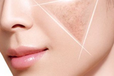 【獨家】福州鼻整形醫(yī)生名錄，5大專家綜合排名、最新價格一覽！