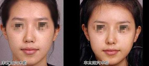 東莞哪家植發(fā)醫(yī)院口碑更好？這些知名醫(yī)院值得關注