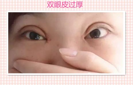 汕頭伊麗莎白醫(yī)療美容診所服務(wù)口碑分析，醫(yī)生實(shí)力深度解讀__成功案例報道