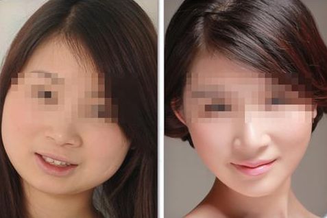 國(guó)內(nèi)備受矚目的小拉皮手術(shù)頂級(jí)專(zhuān)家一覽