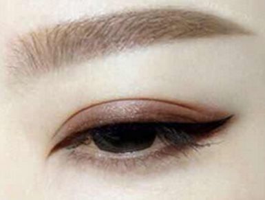 盧尚兵醫(yī)生成功挖掘雙眼皮修復(fù)秘密，踏實(shí)解決眼皮腫脹問(wèn)題