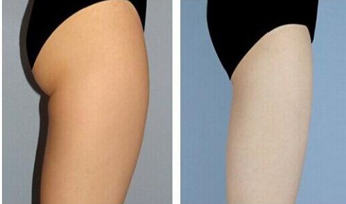 廣州著名種植牙醫(yī)生聚焦！當?shù)責衢T牙醫(yī)簡介匯總