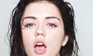 朱亞麗醫(yī)生實例分享：專業(yè)激光祛斑效果如何？