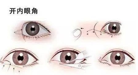 北京哪家專業(yè)醫(yī)院提供高水平的拉皮手術(shù)服務(wù)？權(quán)威機(jī)構(gòu)，口碑一流，高性價(jià)比可靠選擇！