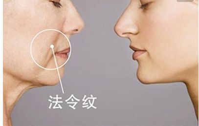 長沙田毅雙眼皮手術(shù)新穎獨(dú)特，引領(lǐng)2023最新潮流