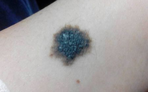 深圳青逸植發(fā)醫(yī)院技術(shù)好不好？醫(yī)生團隊如何？能否令人信任？