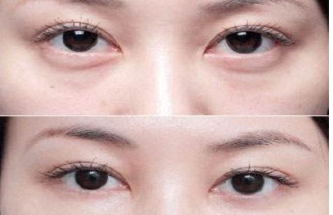 沈陽(yáng)哪個(gè)醫(yī)院的整形專家口碑好，醫(yī)術(shù)高超的醫(yī)生推薦