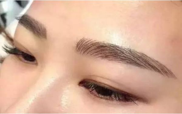 何晉龍磨骨成功，面容煥然一新！讓人難以置信的手術(shù)效果！