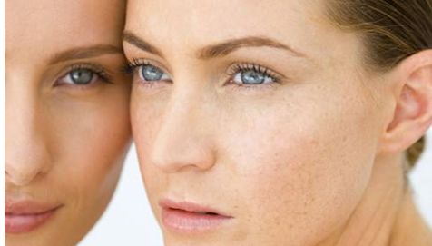 眼部修復(fù)案例比較：2023年眼睛整形術(shù)于曉波和劉輔容，哪個(gè)更理想的選擇