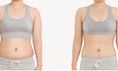 協(xié)和醫(yī)院提供熱瑪吉和超生炮手術(shù)，專家推薦！手術(shù)費用一覽表僅參考！