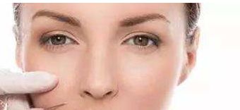 浙醫(yī)二院薛旦雙眼皮效果及價(jià)格詳情，醫(yī)生特長(zhǎng)與病例分享