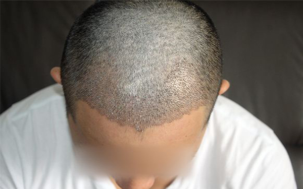 北京京一中醫(yī)醫(yī)院整形項(xiàng)目擅長(zhǎng)什么？醫(yī)生們有什么秘訣？