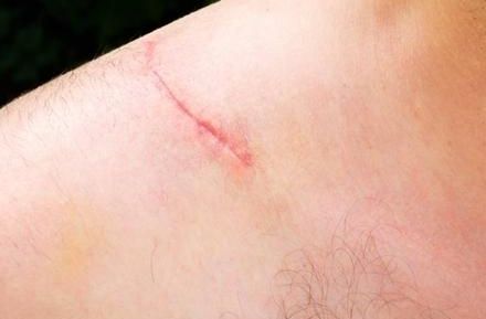 全國隆鼻專家排行榜發(fā)布！實力專家揭秘，經(jīng)驗豐富！