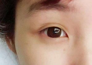 2023寧波隆鼻醫(yī)生排行榜：張廣巍、任森洋、肖慶華五位備受矚目的醫(yī)師解析及收費信息！