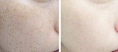 2023昆明下頜角整形臉部護(hù)理達(dá)人該怎么樣選擇？陳曦、錢靜、楊保祥等讓您信賴！