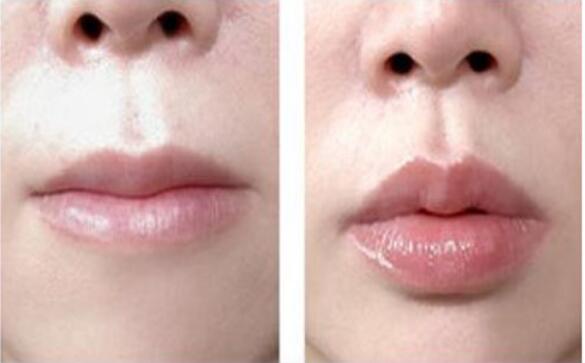 北京柏麗整形醫(yī)院的整形效果如何？有哪些專(zhuān)家醫(yī)生可以選擇？