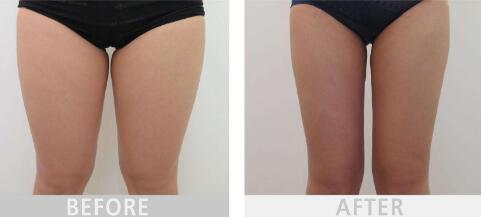 2023年德化縣醫(yī)院整形外科價目表是否已經(jīng)公布？鄭向陽的口碑和經(jīng)驗如何進行深度評點？案例欣賞？