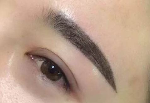 上海薇琳整形醫(yī)院：近期面部吸脂驚艷案例揭秘！