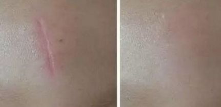 唐毅整形外科醫(yī)生胸部整形術(shù)效果如何？附最新出診信息