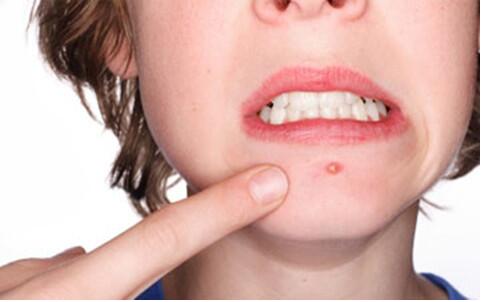 貴陽(yáng)激光祛斑公立醫(yī)院哪家費(fèi)用透明可信賴？2023更全排行榜！