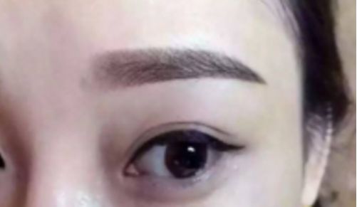 鄭州哪家整形醫(yī)院排名前五，取出異物效果好