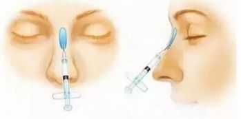 上海五位備受矚目的雙眼皮修復專家，讓你放心選擇