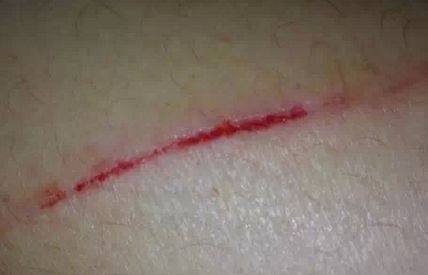 北京聯(lián)合麗格首席醫(yī)生陣容，精選4位超贊吸脂醫(yī)師