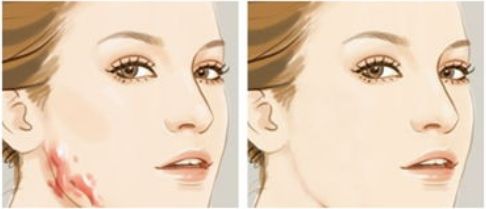 杭州市最受推崇的做雙眼皮手術(shù)的頂級(jí)醫(yī)院大全，技術(shù)高超、口碑出眾一網(wǎng)打盡