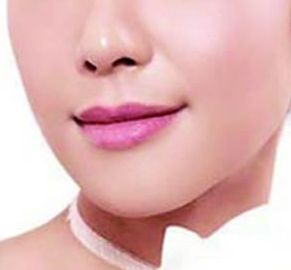 哪位西安醫(yī)生擅長割雙眼皮，割雙眼皮技術(shù)如何？