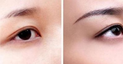 重慶頂尖眼部整形醫(yī)生、醫(yī)院排行榜一覽