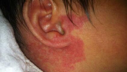 空軍總醫(yī)院整形科怎么樣？從隆鼻醫(yī)生到科普分享，真的那么靠譜嗎？