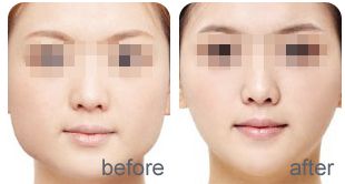 濟南頂級醫(yī)美整形機構(gòu)排行榜！口碑爆棚，超高人氣！