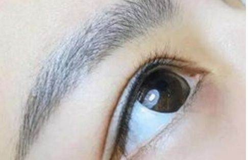 廣州名麗醫(yī)療美容醫(yī)院隆鼻案例分享：真實口碑大揭秘！