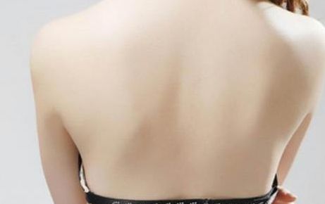 華西醫(yī)院李正勇醫(yī)生的雙眼皮技術水平與特點解析