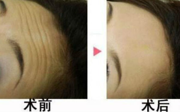 西安陽光整形醫(yī)院靠譜嗎？醫(yī)生背景和價格怎么樣？