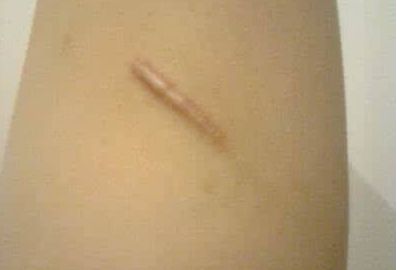 重慶最佳專業(yè)雙眼皮手術(shù)，醫(yī)生名單與真實(shí)案例圖震撼揭秘