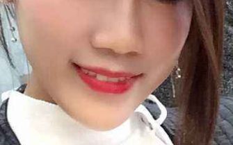 黃印資技術的鼻子風格與個人資料+隆鼻案例