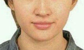 曹衛(wèi)剛vs.張超，比一比！探討九院兩位實(shí)力整形醫(yī)生的特長(zhǎng)對(duì)比