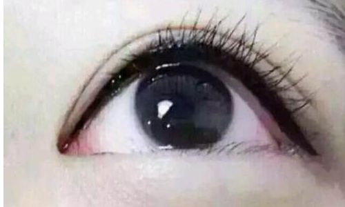 西安藝星鼻子塑造實(shí)例揭秘！2023年全新對(duì)比案例分享