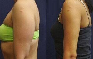 杭州最佳拉皮手術(shù)醫(yī)生盤點：十位頂尖專家為您揭秘