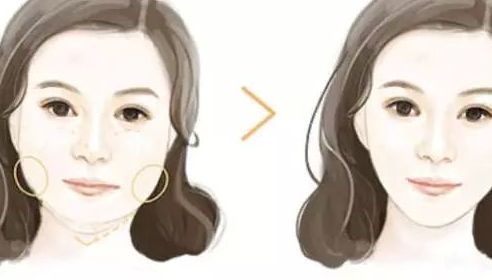 濟南整形美容醫(yī)院哪家好？諾德、藝星、韓氏躋身手術(shù)排行榜