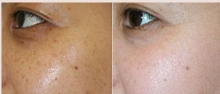 成都軍大整容醫(yī)院吸脂技術(shù)的價格對比及效果調(diào)查