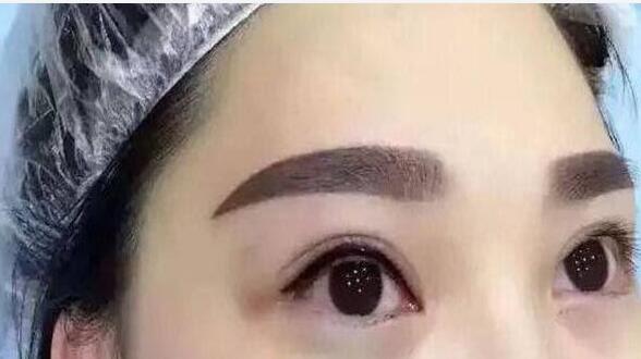 深圳港龍醫(yī)院的醫(yī)生口碑如何？醫(yī)生的技術(shù)水平如何評(píng)價(jià)？