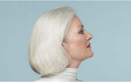 鄭州華領(lǐng)整形醫(yī)院豐胸效果一覽，2023瘦身成功故事詳解